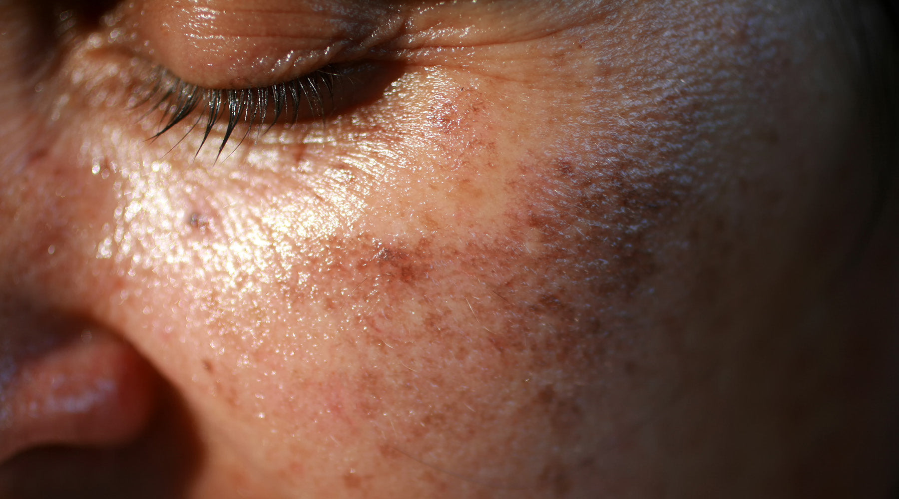 Radiant Revival: Achieving an Even Skin Tone and Diminishing Discolouration