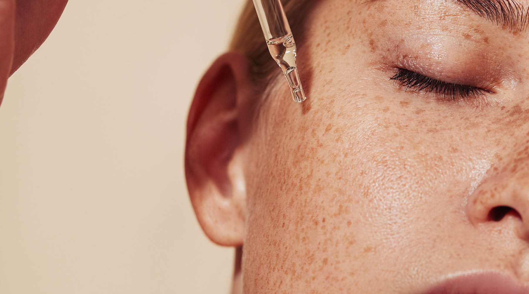 Pigmentation: Why It Keeps Coming Back (And What You Can Do About It)