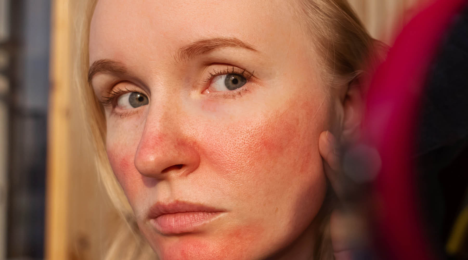 Your Skin Isn't the Problem. The Unpredictability Is.