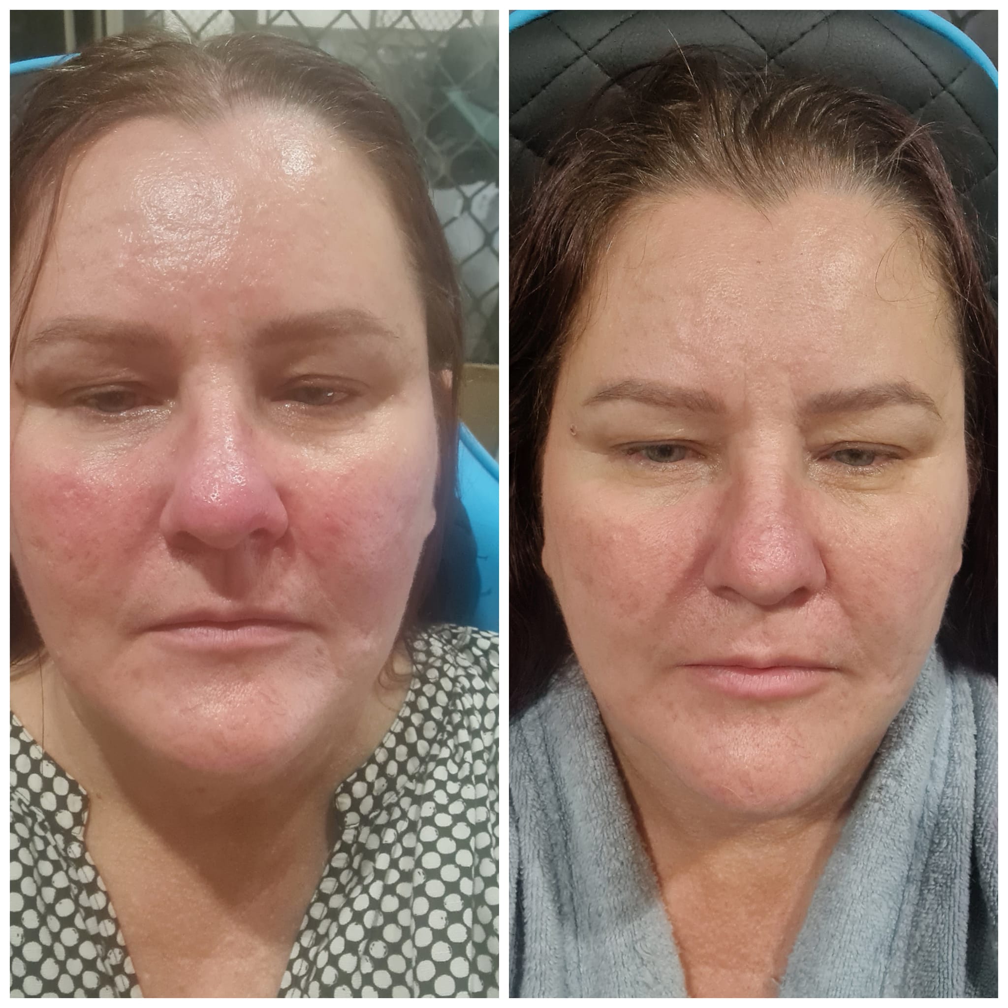 Overnight Recovery Mask